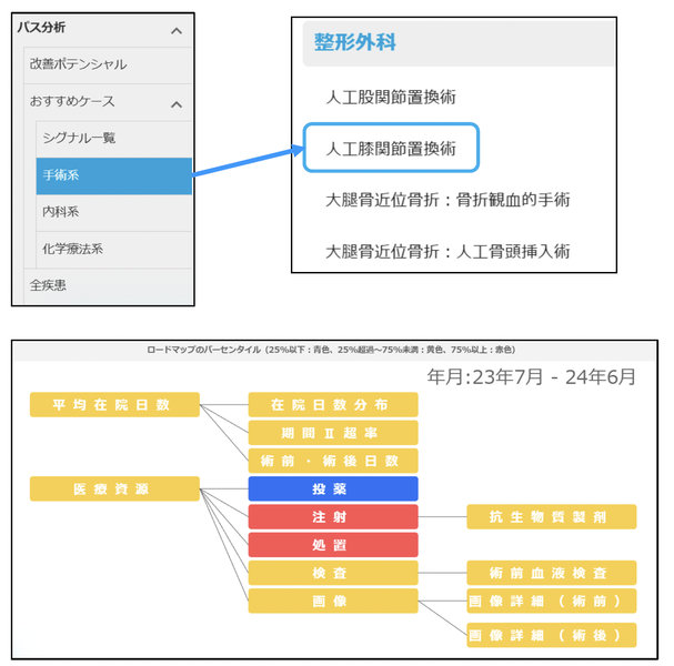 パス分析>おすすめケース>手術系>人工膝関節置換術